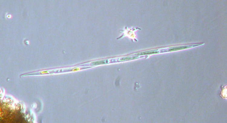 Pseudo-nitzscnia spp.